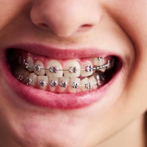 Matéria Instituto Marpeh – 15 de setembro/2025